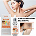 Black Wattle Essential Oil, Repair Underarm Joint Black Whitening Skin Light Spots Skin Beauty Essence Oil