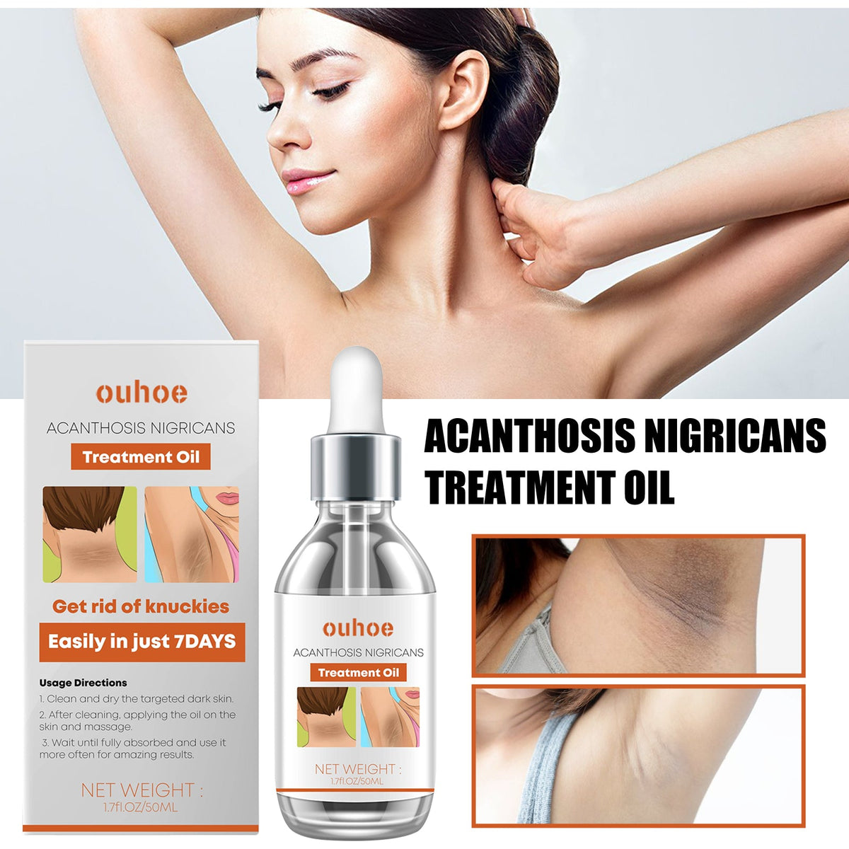 Black Wattle Essential Oil, Repair Underarm Joint Black Whitening Skin Light Spots Skin Beauty Essence Oil