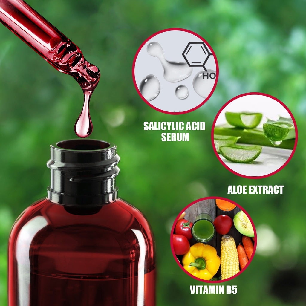 AHA30% + BHA 2% Fruit Acid Salicylic Acid Essence, Exfoliating Cleaning Blackheads Acne And Shrinking Pores Essence