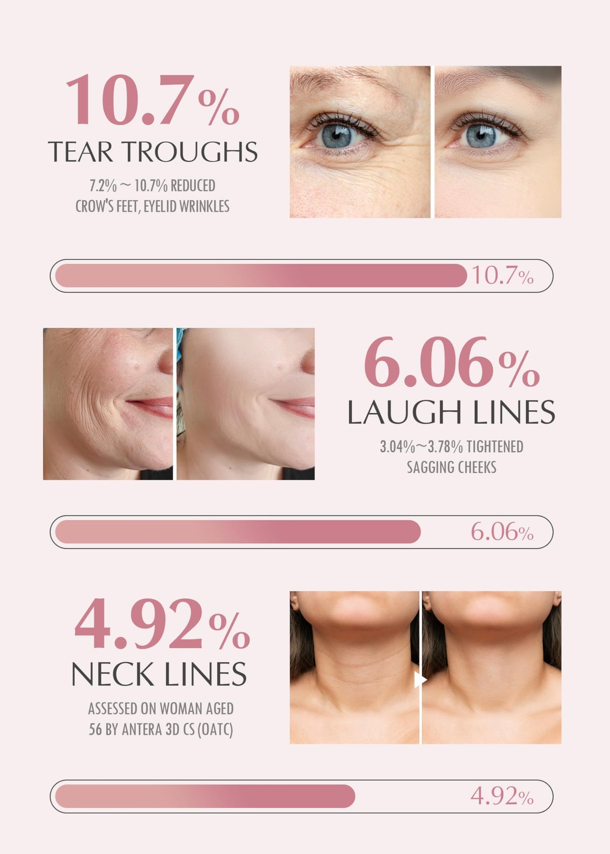 KAHI Wrinkle Bounce Multi Balm Stick | PDRN Collagen Wrinkle Stick | Korean Skin Care |All-in-One Hydrating Lip Balm Eye Cream Neck Cream Make Up Base & Face Mist Moisture Balm