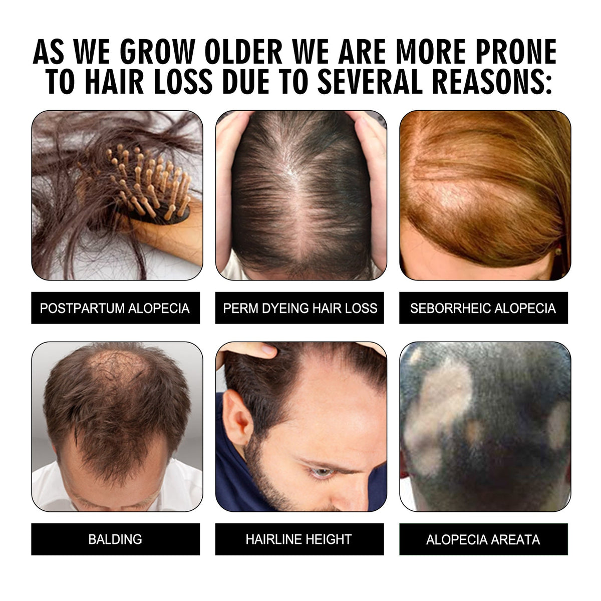 Hair Conditioning Essence, Repair Dull Smooth Hair And Scalp Massage Treatment Hair Conditioning Essence