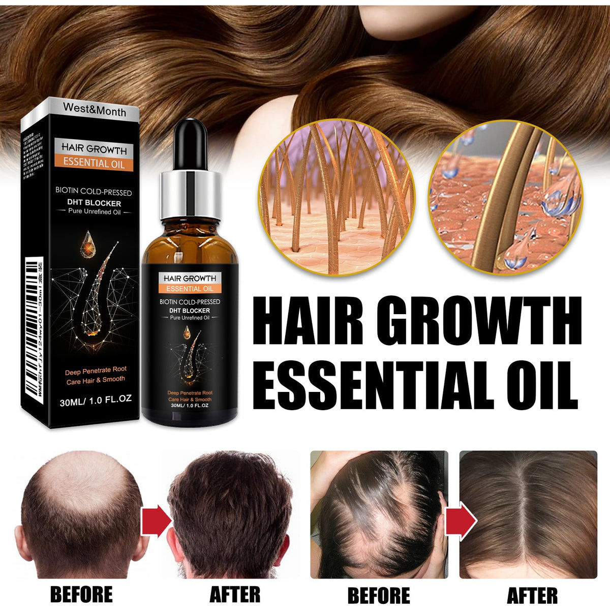 Hair Growth Essential Oil, Dense Hair Growth Repair Dry Hair And Moisture Hair Essence