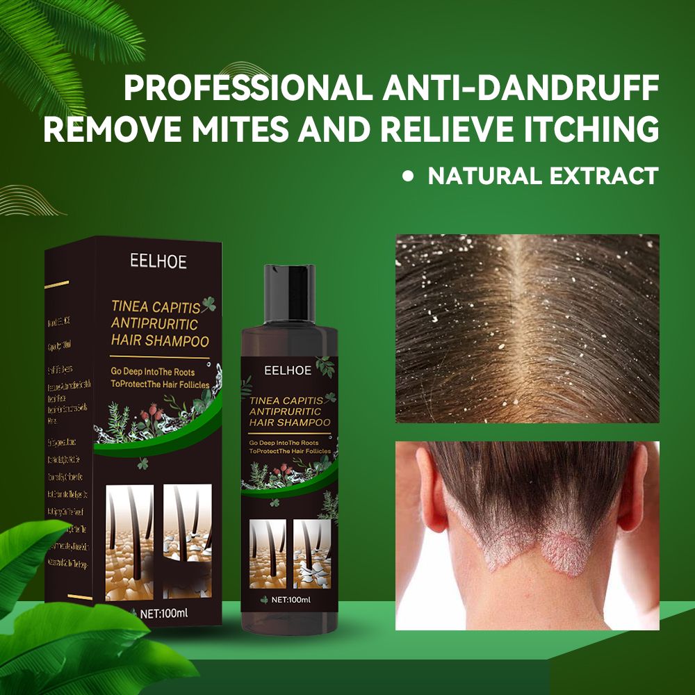 Anti-Dandruff Shampoo,Shampoo For Scalp Prone To Folliculitis, Dermatitis, Dandruff, Itchy And Flaky Scalp,Treats Dandruff And Seborrheic Dermatitis,Anti-Itch Shampoo